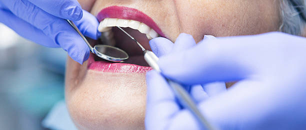 Best Emergency Root Canal Treatment in Syracuse, NY